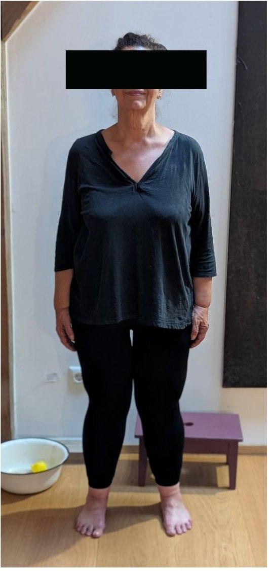 Nachher-Foto, Transformation 01
