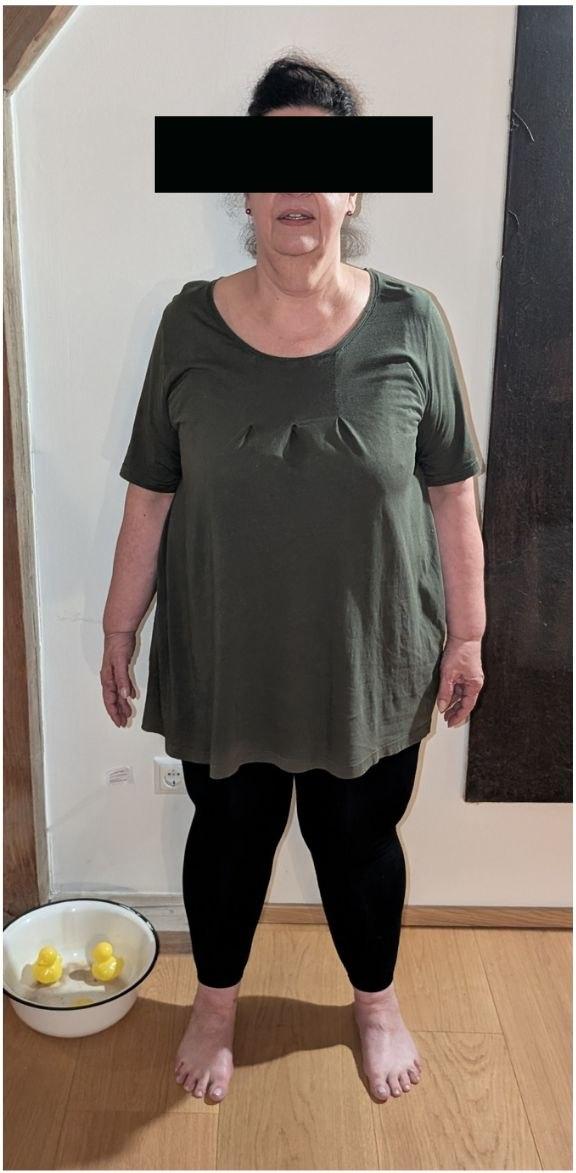 Vorher-Foto, Transformation 01