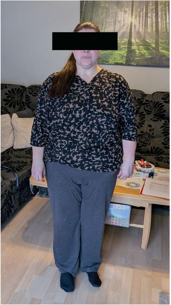 Vorher-Foto, Transformation 02